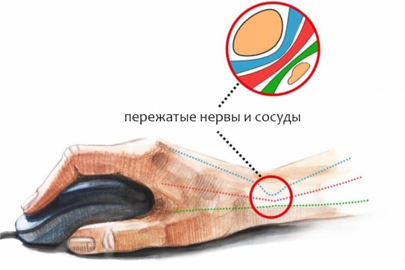 Ссылка на кракен onion kraken dark link